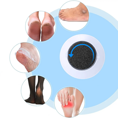 Callus and Crack Remover